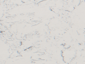 再生大理石PX0591 塔克灰网纹